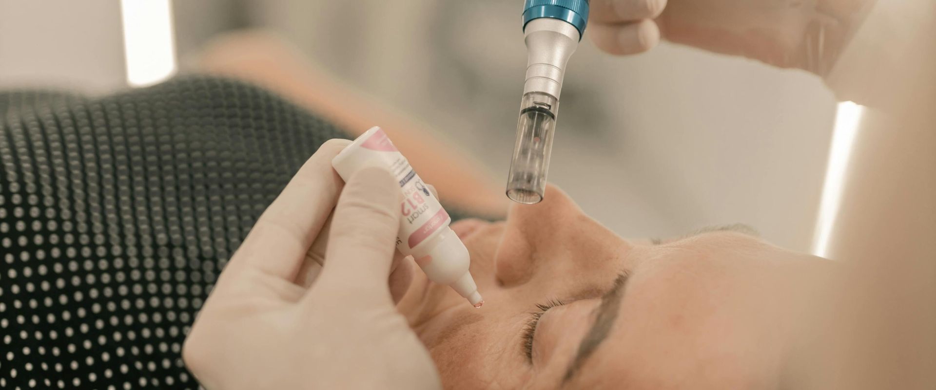 Close-up of person receiving microneedling beauty treatment in a clinic.